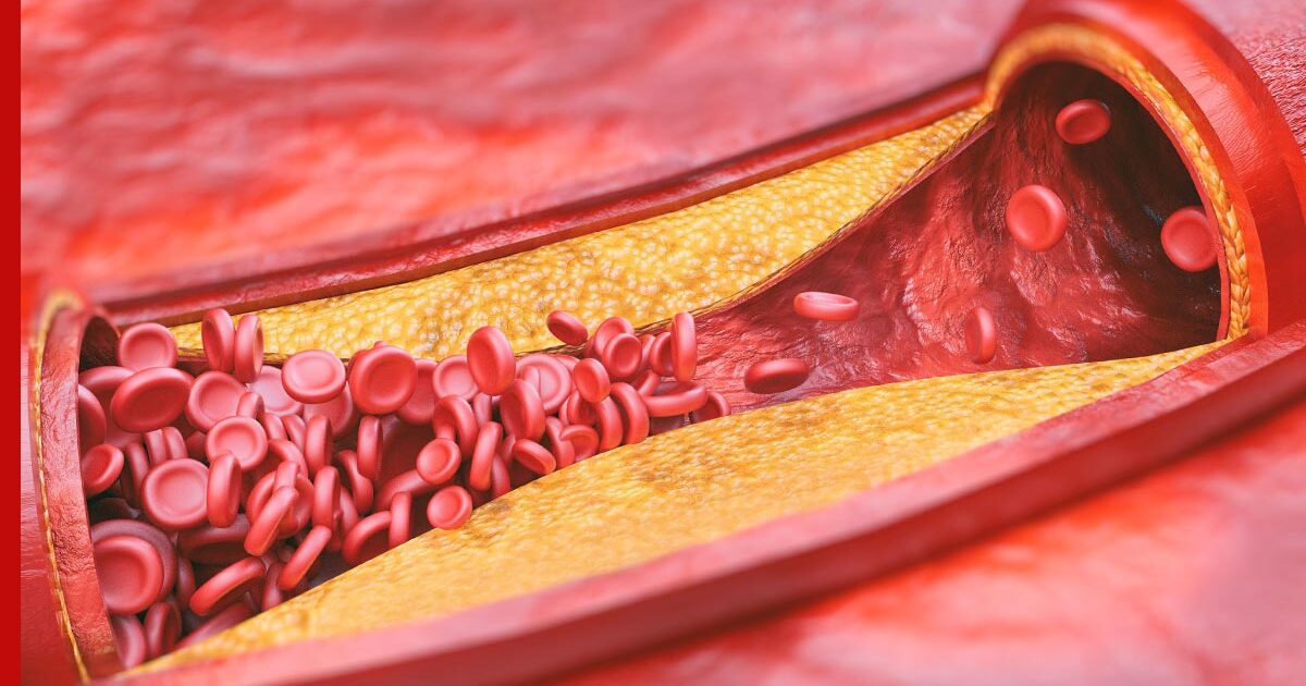 Мифы о холестерине: специалисты перечислили 5 распространенных заблуждений